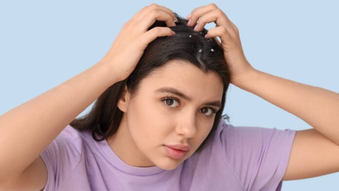 Zinc for dandruff: How to use it to deal with this scalp condition