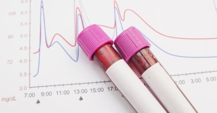 Vials of blood over a blood sugar chart