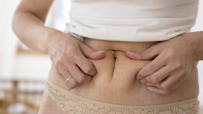 Menopause belly: What is it and how to deal with it