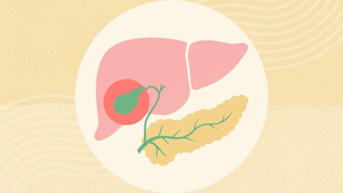 What Is Acalculous Cholecystitis?