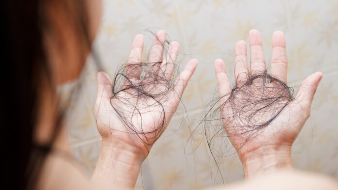 International Alopecia Day 2025: Cosmetic surgeon explains why autoimmune hair loss is rising
