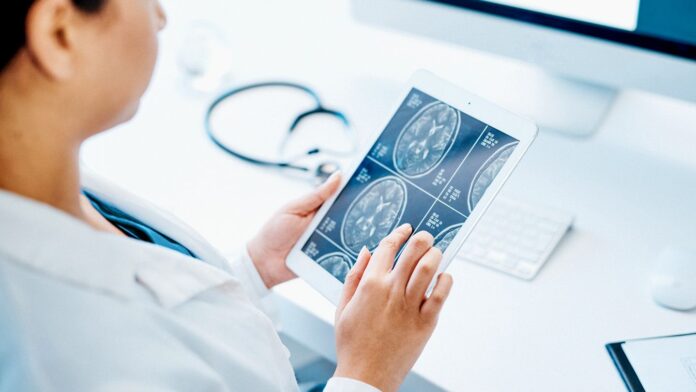 Understanding the Shift from Relapsing-Remitting MS to Secondary-Progressive MS